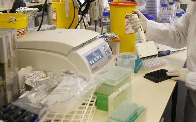 Yiaco has incurred losses worth KWD 1.36 million in FY18